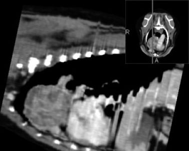 computertomographie-planung-operation