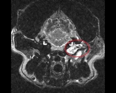 Otitis-media-externa